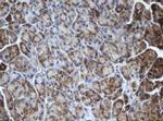 MIPEP Antibody in Immunohistochemistry (Paraffin) (IHC (P))