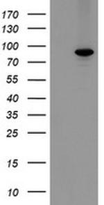 MIPEP Antibody in Western Blot (WB)