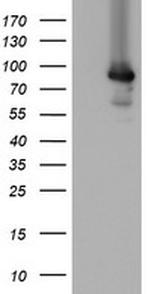 MIPEP Antibody in Western Blot (WB)