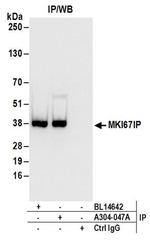 MKI67IP Antibody in Western Blot (WB)