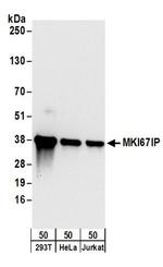 MKI67IP Antibody in Western Blot (WB)