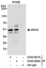 MKK4 Antibody in Immunoprecipitation (IP)