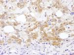 MKK7 Antibody in Immunohistochemistry (IHC)