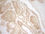 MKL1 Antibody in Immunohistochemistry (Paraffin) (IHC (P))