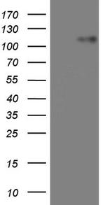 MKL1 Antibody in Western Blot (WB)