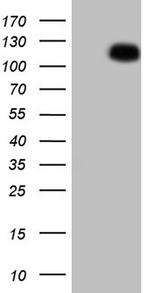 MKL1 Antibody in Western Blot (WB)