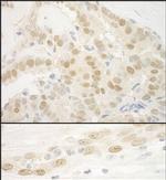 MKL2 Antibody in Immunohistochemistry (IHC)