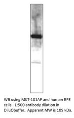 MERTK Antibody in Western Blot (WB)