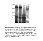 MERTK Antibody in Western Blot (WB)