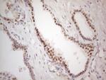 MKX Antibody in Immunohistochemistry (Paraffin) (IHC (P))