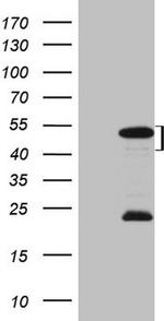 MKX Antibody in Western Blot (WB)