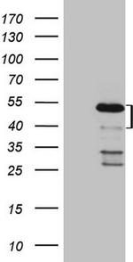 MKX Antibody in Western Blot (WB)