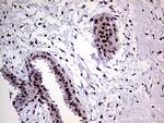 MLH1 Antibody in Immunohistochemistry (Paraffin) (IHC (P))