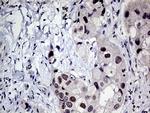 MLH1 Antibody in Immunohistochemistry (Paraffin) (IHC (P))