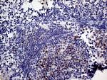 MLH1 Antibody in Immunohistochemistry (Paraffin) (IHC (P))