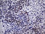 MLH1 Antibody in Immunohistochemistry (Paraffin) (IHC (P))