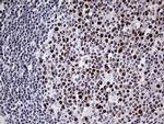 MLH1 Antibody in Immunohistochemistry (Paraffin) (IHC (P))