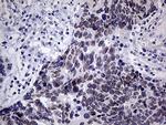 MLH1 Antibody in Immunohistochemistry (Paraffin) (IHC (P))