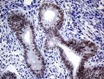 MLH1 Antibody in Immunohistochemistry (Paraffin) (IHC (P))