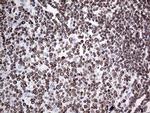 MLH1 Antibody in Immunohistochemistry (Paraffin) (IHC (P))