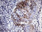 MLH1 Antibody in Immunohistochemistry (Paraffin) (IHC (P))