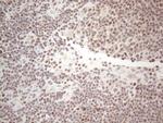 MLH1 Antibody in Immunohistochemistry (Paraffin) (IHC (P))