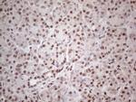 MLH1 Antibody in Immunohistochemistry (Paraffin) (IHC (P))