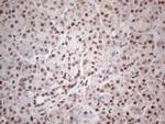 MLH1 Antibody in Immunohistochemistry (Paraffin) (IHC (P))