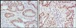 MLH1 Antibody in Immunohistochemistry (Paraffin) (IHC (P))