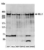 MLL1 Antibody in Western Blot (WB)