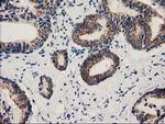 MMAB Antibody in Immunohistochemistry (Paraffin) (IHC (P))