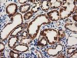 MMAB Antibody in Immunohistochemistry (Paraffin) (IHC (P))