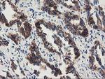 MMAB Antibody in Immunohistochemistry (Paraffin) (IHC (P))