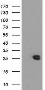 MMAB Antibody in Western Blot (WB)