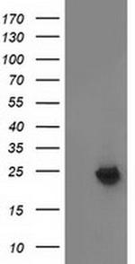 MMAB Antibody in Western Blot (WB)