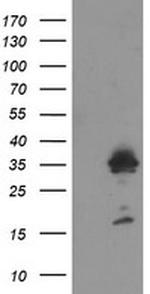 MMACHC Antibody in Western Blot (WB)