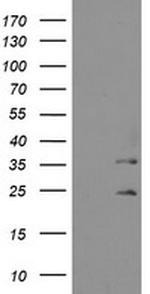 MMACHC Antibody in Western Blot (WB)