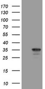 MMACHC Antibody in Western Blot (WB)