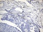 MME Antibody in Immunohistochemistry (Paraffin) (IHC (P))