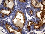 MME Antibody in Immunohistochemistry (Paraffin) (IHC (P))