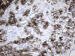 MME Antibody in Immunohistochemistry (Paraffin) (IHC (P))