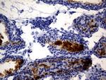 MME Antibody in Immunohistochemistry (Paraffin) (IHC (P))