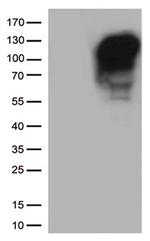 MME Antibody in Western Blot (WB)