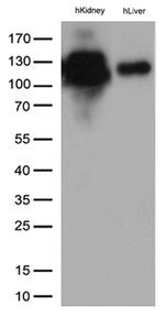 MME Antibody in Western Blot (WB)