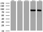 MME Antibody in Western Blot (WB)