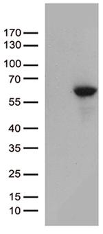 MMP11 Antibody in Western Blot (WB)
