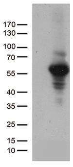 MMP11 Antibody in Western Blot (WB)