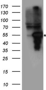 MMP11 Antibody in Western Blot (WB)