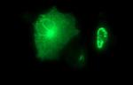 MMP13 Antibody in Immunocytochemistry (ICC/IF)