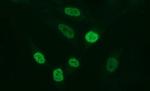 MMP13 Antibody in Immunocytochemistry (ICC/IF)